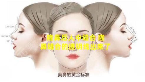 隆鼻后人中缝合 隆鼻缝合的透明线出来了